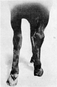 Fig. 57&mdash;Thoroughpin. Showing distension of the sheath of
the deep flexor tendon as it protrudes antero-externally to the fibular
tarsal bone (calcaneum).