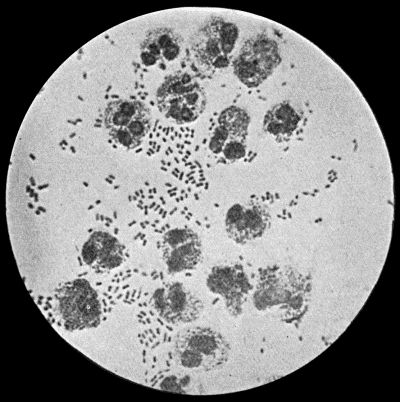 Fig. 4.&mdash;Bacillus coli communis in Urine, from a case of Cystitis. &times; 1000 diam. Leishman's stain.