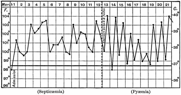 Fig. 12.&mdash;Chart of case of Septic&aelig;mia followed by Py&aelig;mia.