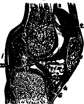 Illustration:
Fig. 18.