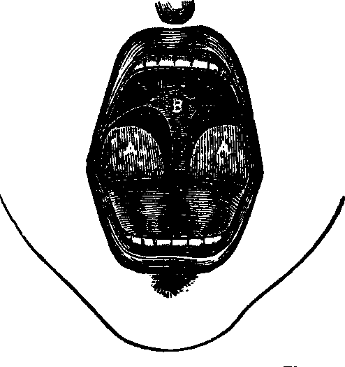 Illustration:
Fig. 147.