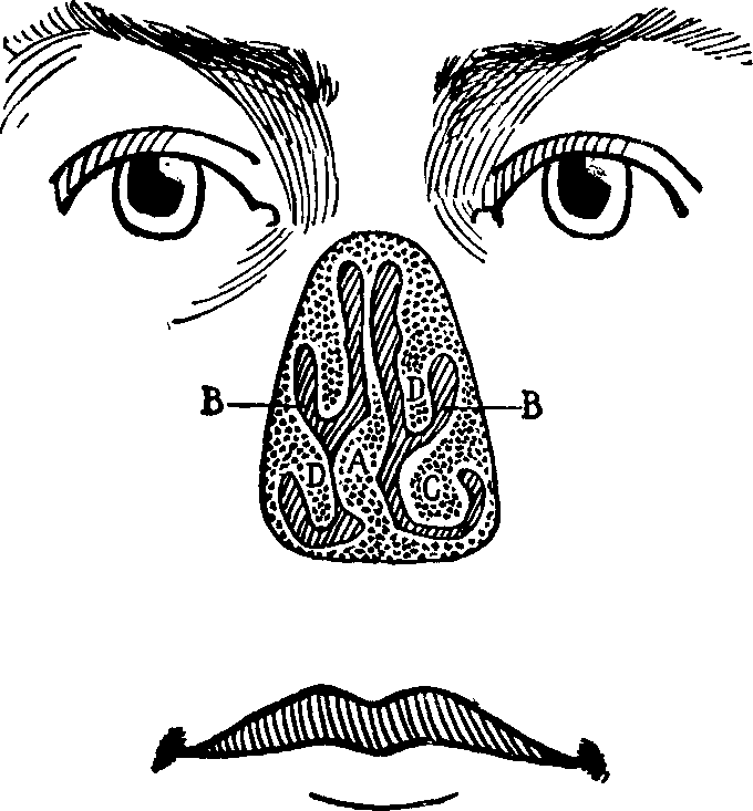 Illustration:
Fig. 15. Anterior view of deformed nasal passages as seem with the
projecting portion of the nose removed.
