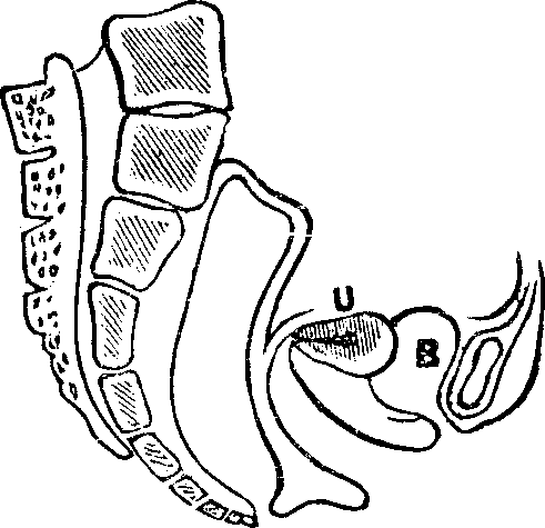 Illustration:
Fig. 11. Version, u, Uterus, B, Bladder.
