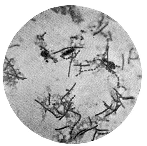 Photo-micrograph of preparation from Armenian
soured milk