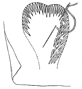 Fig. 4.&mdash;Feather or Crewel Stitch&mdash;a mixture of long and
short stitches.