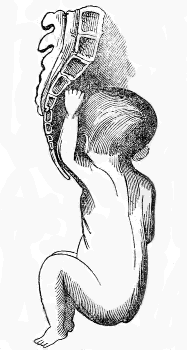 Trunk
fully descended