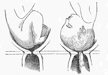 neck of
the Womb, at near the end of nine months
