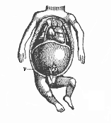 Fig.357. Thoracic and
abdominal viscera of a human embryo of twelve weeks.